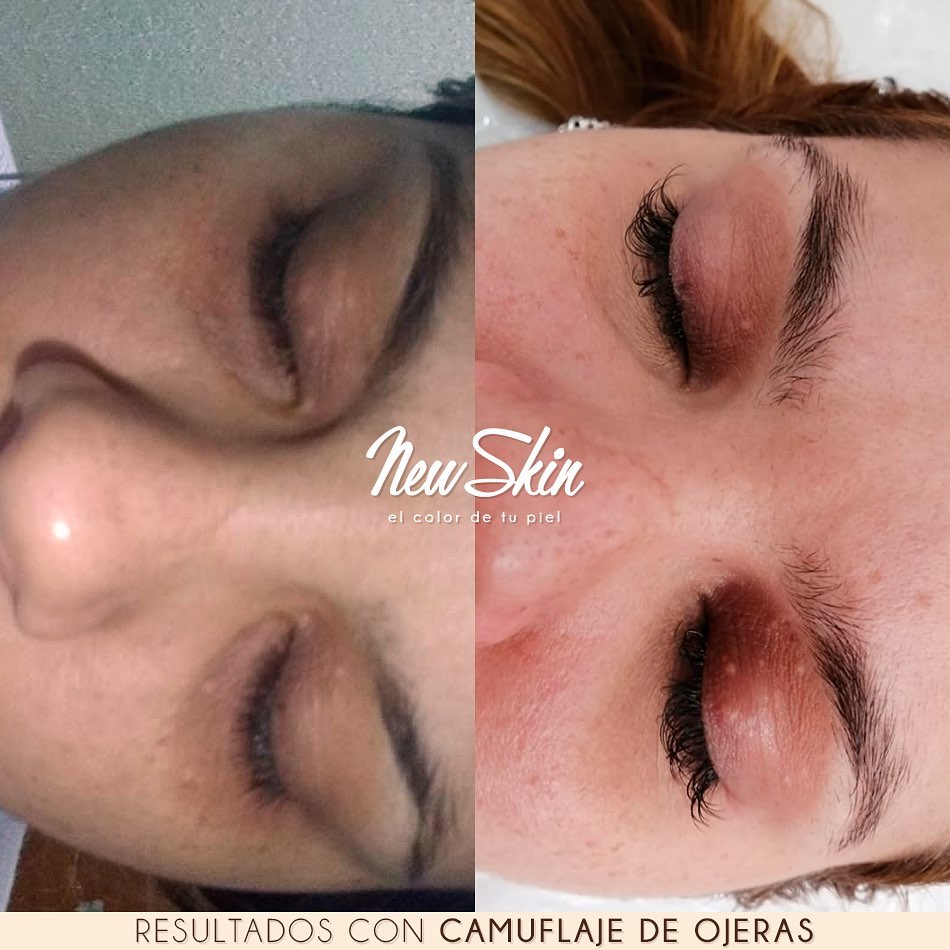 Ojerasantesdesp