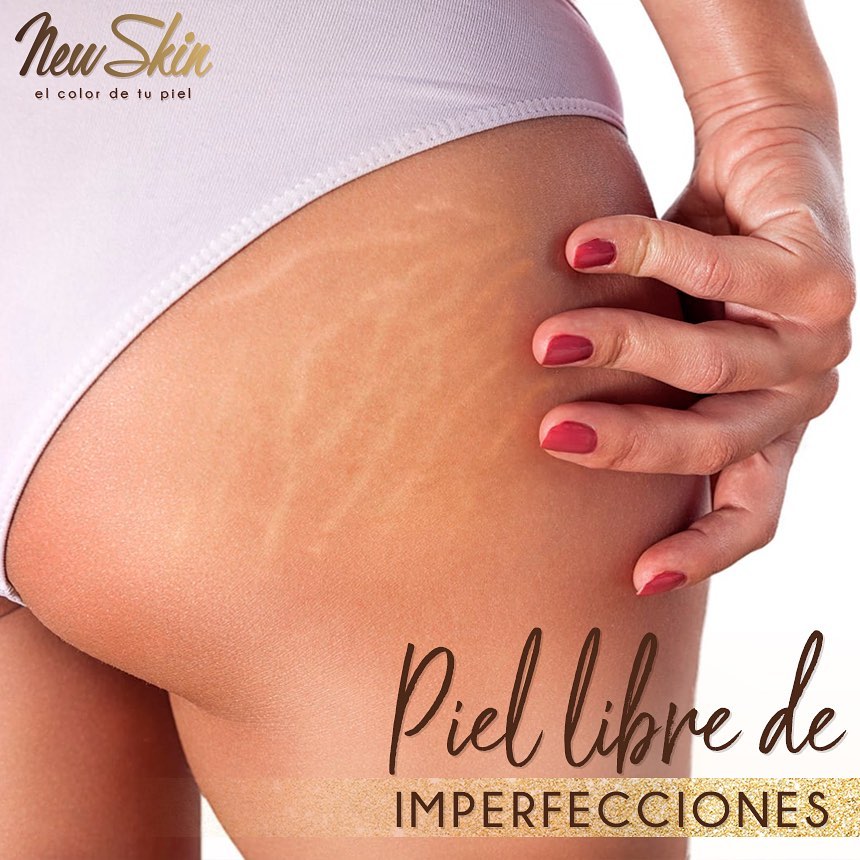 cMUFLje imperfecciones