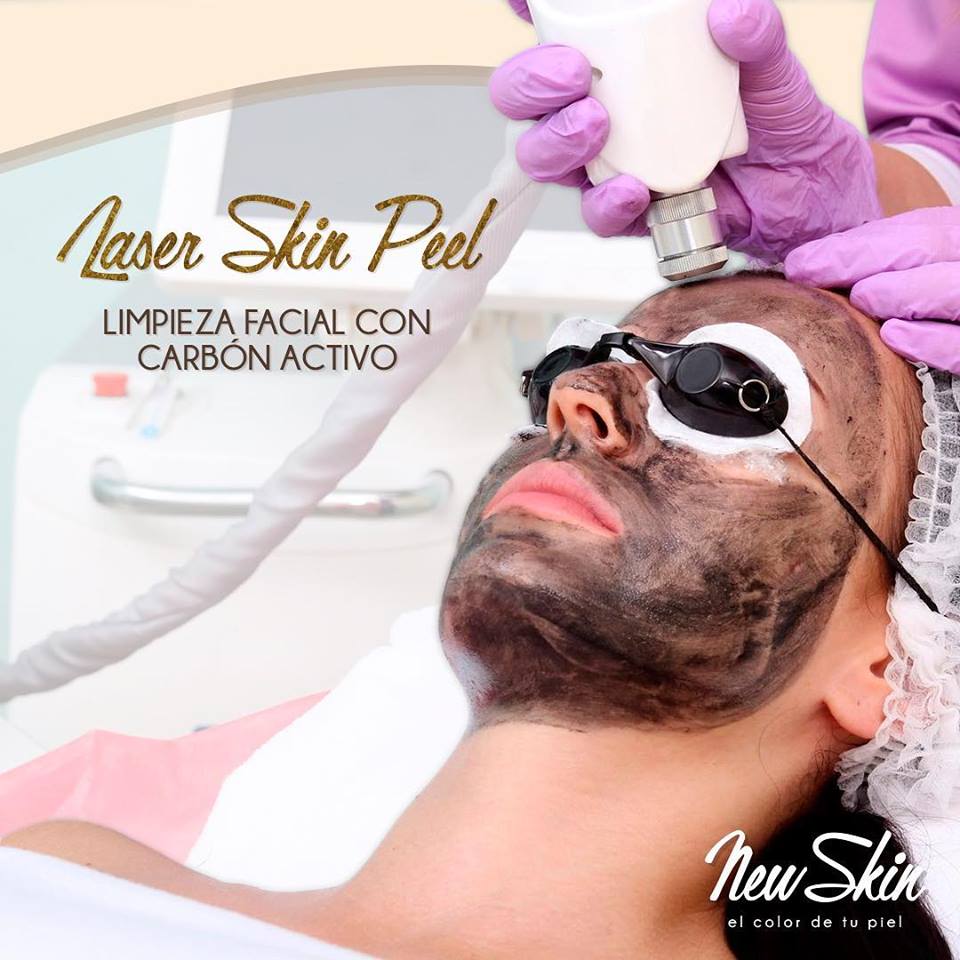 cabonpeel