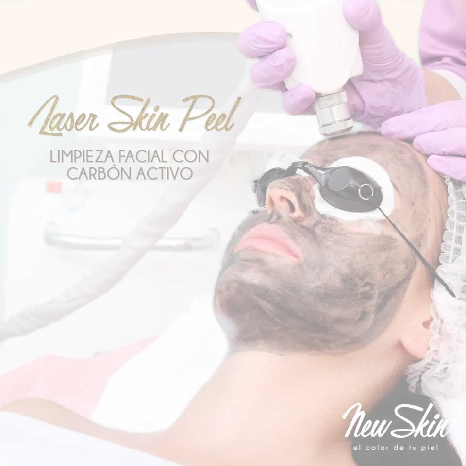 cabonpeel1