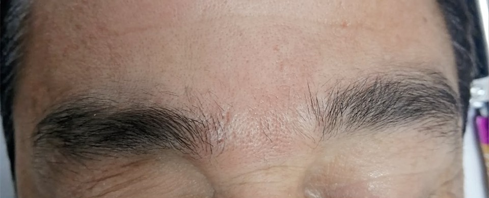 hypdesp